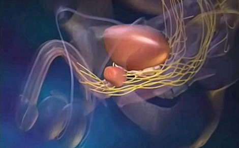 Prostat , mesane ve damar-sinir paketinin anatomik yerleşimi