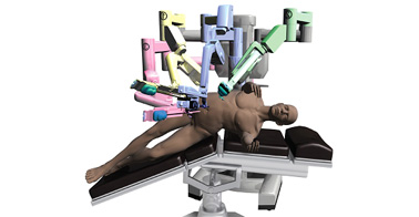 Robotik piyeloplasti - Prof. Dr. Haluk akpınar